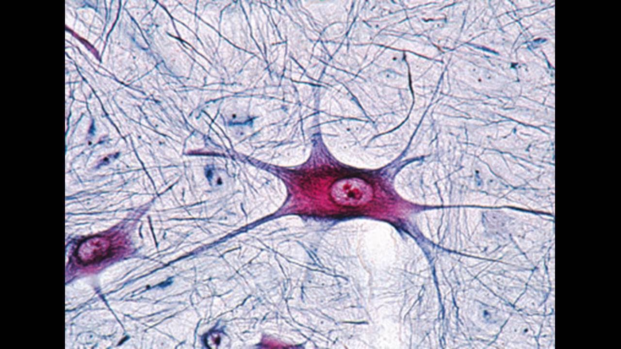 Деление нервных клеток. Клетки ЦНС гистология. Нервные клетки под микроскопом гистология. Нервная ткань микропрепарат. Нервные клетки микроскоп.