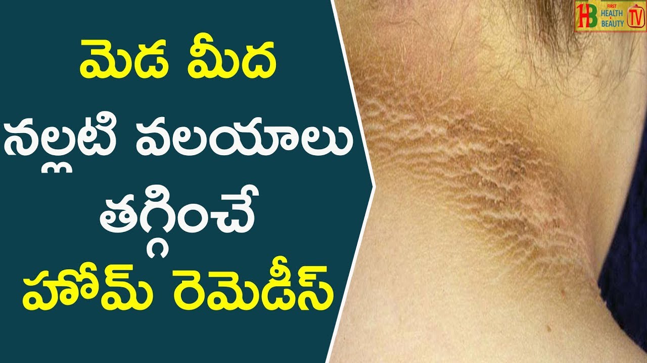 మెడ మీద నల్లటి వలయాలు తగ్గించే హోమ్ రెమెడీస్ || How To Get Rid Of Darkness On Neck - Beauty Tips glowing skin captions