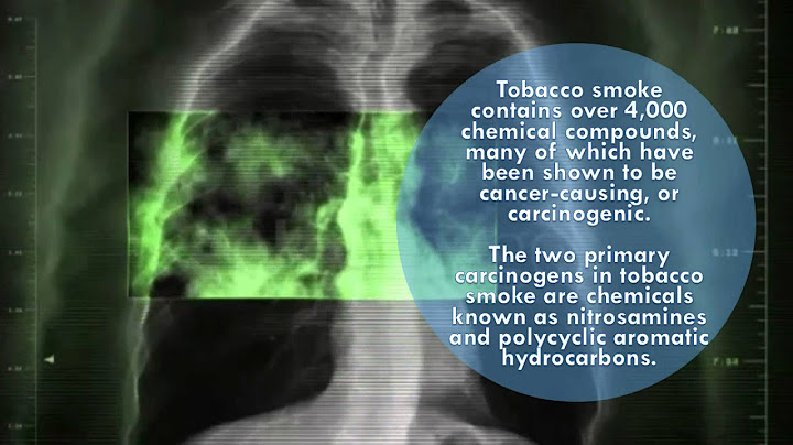 Top 5 diseases you can get from smoking