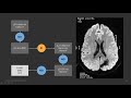 Como diferenciar una TC de una RM de cerebro