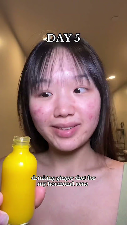 Do people actually enjoy ginger shot? 🥵 #viral #acne #gingershot #shorts