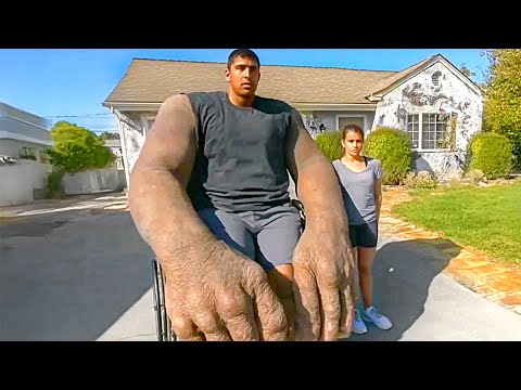 15 People With Body Parts Bigger Than Normal