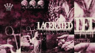 [EGxHC] Lacerated - A Scene of Transition - 2026 (Full EP)