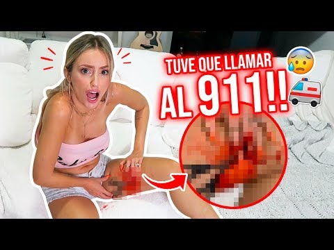 CORTE MI PIERNA POR ACCIDENTE!!😱✂ BROMA CRUEL SE DESMAYÓ!🙊  | Katie Angel