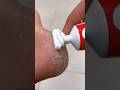 Winter Special Heel Care Remedy at Home फटी एड़ियों से छुटकारा सिर्फ 1 हफ्ते में #HeelCare #shorts