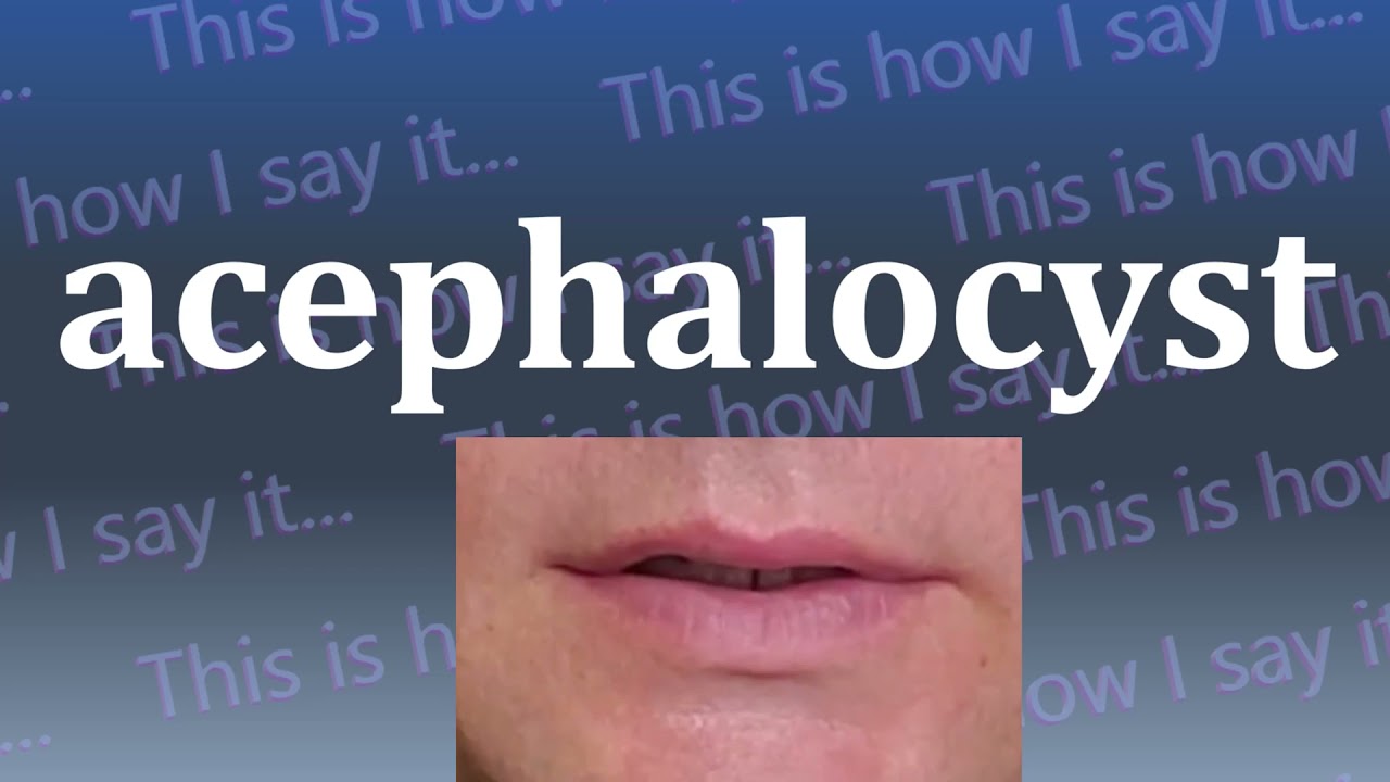 This is How I Say...acephalocyst