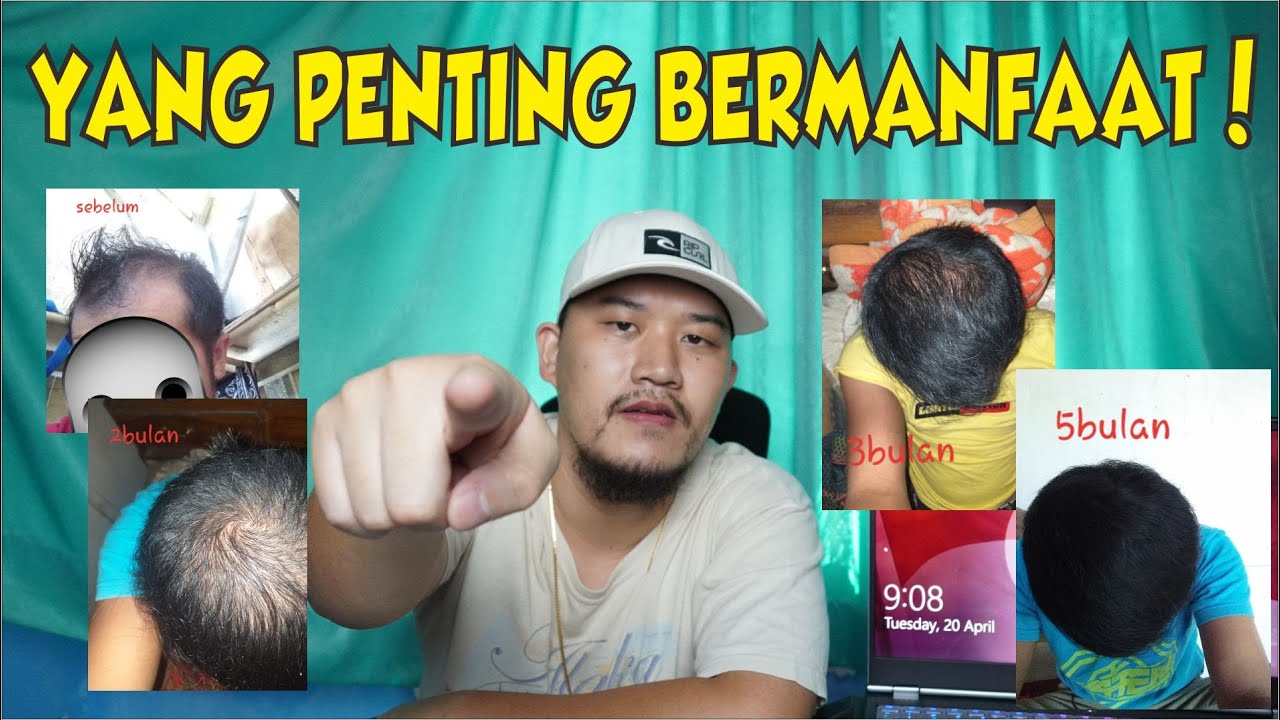 RAMBUT TUMBUH BERKAT NONTON VIDEO KOKOHBREWOK, MANTEP BANGET DEH GW UDAH NGGA PEDULI SAMA HATERS!!!