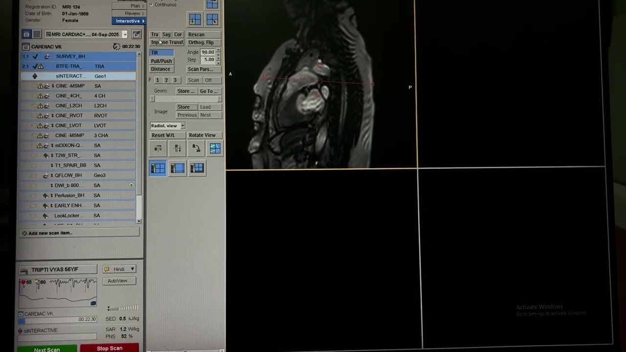Basic planning of cardiac MRI ￼