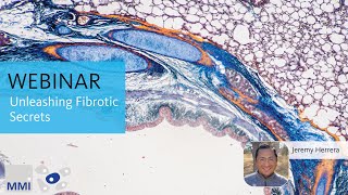 [Webinar] Unleashing Fibrotic Secrets: Coupling the Power of Laser Microdissection with Mass Spec
