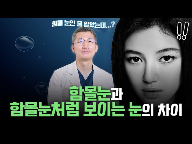함몰눈 쌍꺼풀 라인은 이렇게 수술해야 대박납니다