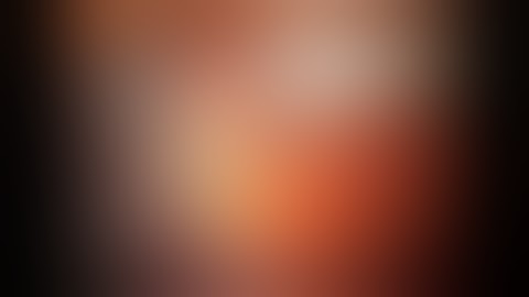 Minimally-invasive components separation without the need for laparoscopy