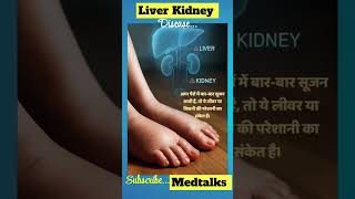 liver & kidney disease signs symptoms #liver #kidney #youtubeshorts @MedTalks777