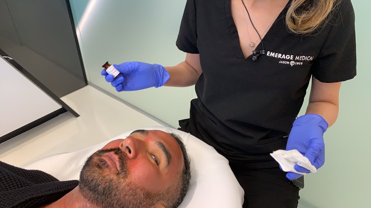 Enlighten Peel | Pigmentation and Skin Tone Improvement | West Hollywood, CA | Dr. Jason Emer