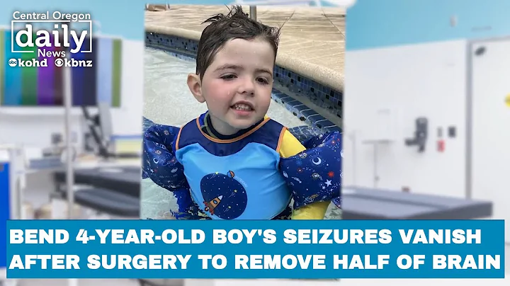 Bend 4-year-old’s seizures vanish after surgery to remove half his brain