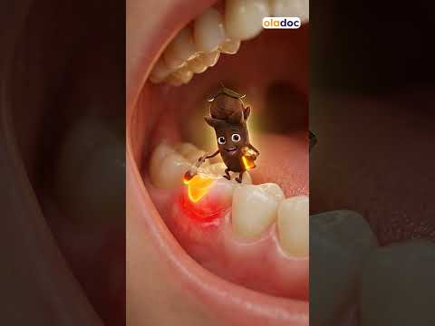 Natural Remedies for a Healthier Smile - Kitchen Hacks for Teeth Whitening #viral #ai  #ytshorts thumbnail image
