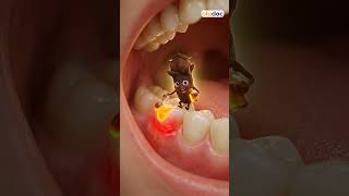 Natural Remedies for a Healthier Smile - Kitchen Hacks for Teeth Whitening #viral #ai #ytshorts