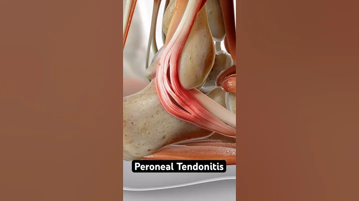 Swollen ankle = tendon damage? (3D Animation)