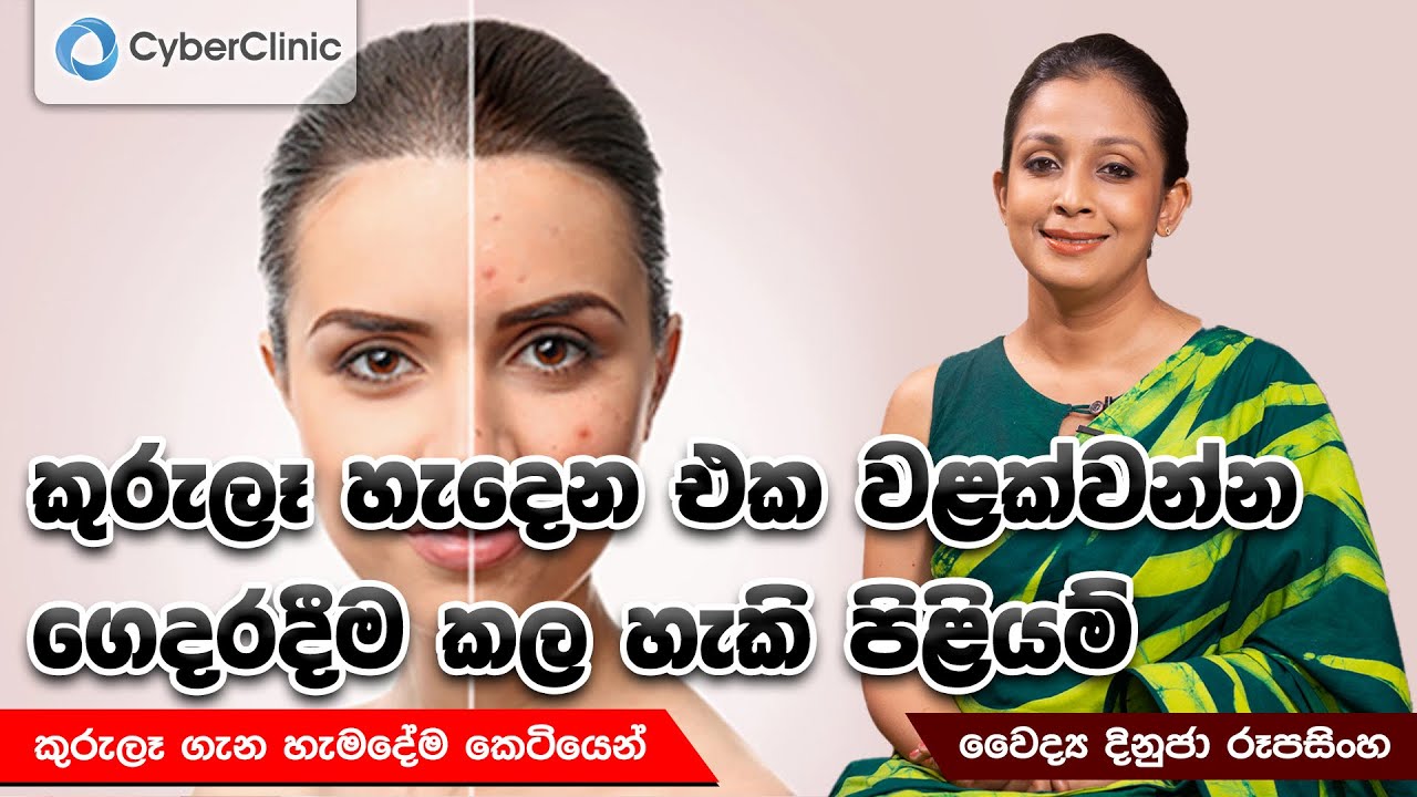 කුරුලෑ හැදෙන එක වළක්වන්න ගෙදරදීම කල හැකි පිළියම් | Dr.DR