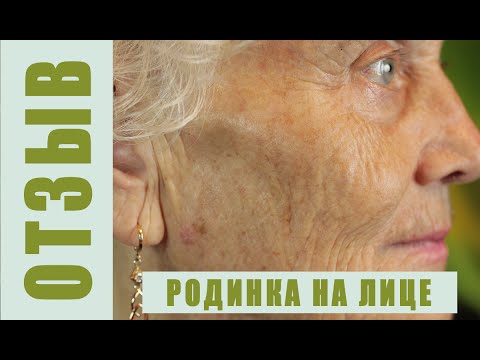 Вирус папилломы человека причины возникновения у женщин