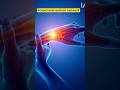 Carpal Tunnel Syndrome Treatment | Wrist Pain Relief Exercises &amp; Physiotherapy Guide