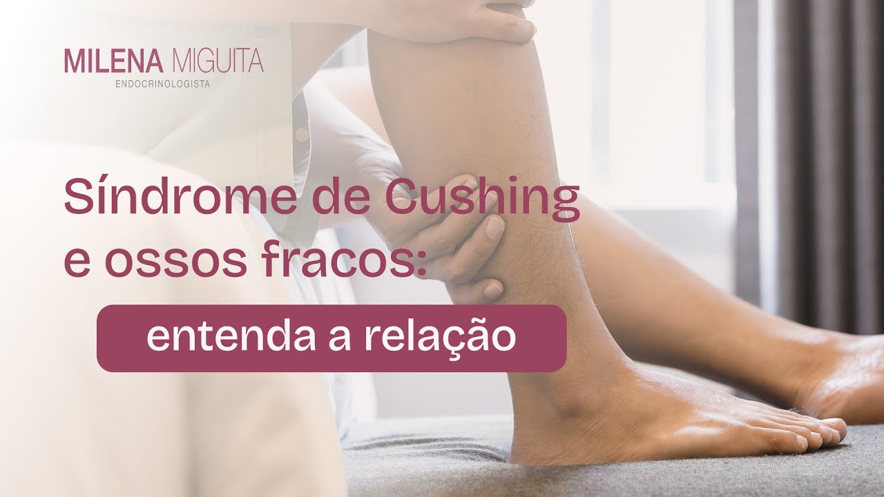 Síndrome de Cushing e ossos fracos: entenda a relação | Dra. Milena ...
