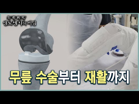   무릎 인공관절 수술부터 조기 재활까지 KBS 20220907 방송