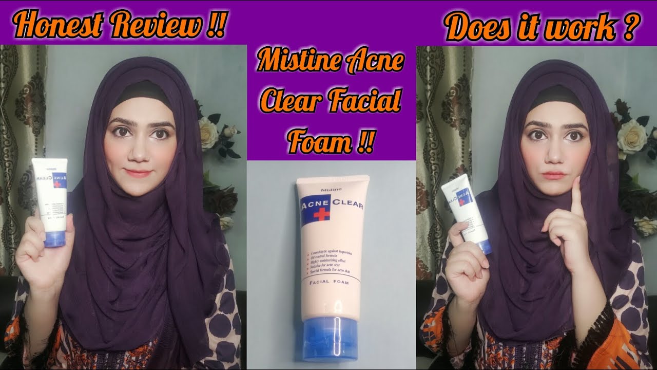 Mistine Acne Clear Facial Foam Review My Experience & Honest Review