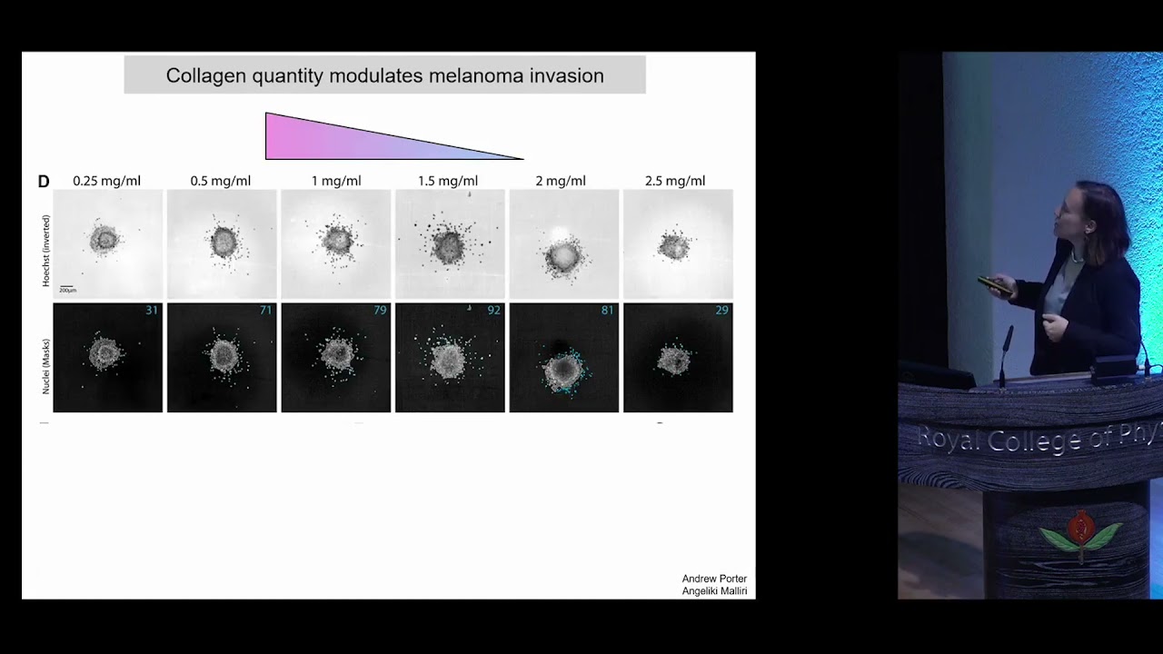 How age and sex shape the biology of skin cancer