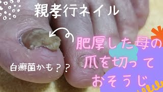 【親孝行ネイル】分厚く肥厚した母の足爪をニッパーで切ってキレイにお掃除　もしかして白癬菌かも？@ほぼ【ダイソー商品】で誰でもできる♪かんたん爪水虫ケア、爪白癬