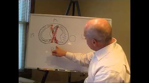 PERMANENT IMPAIRMENTS OF THE KNEE  www.ezcontinuingeducation.org  Perry J. Carpenter DC QME