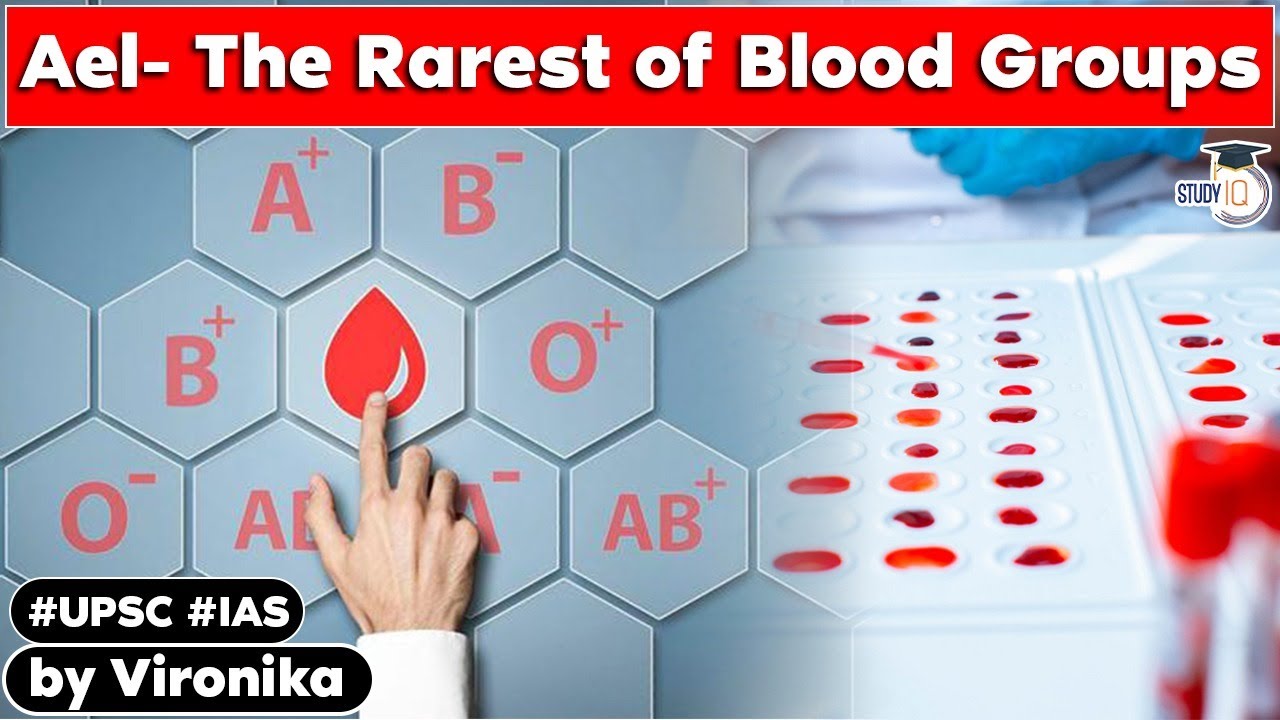 Ael Blood Group A Rarest Of Rare Blood Group Found In 30 year old ael-blood-group-a-rarest-of-rare-blood-group-found-in-30-year-old