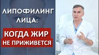 ЛИПОФИЛИНГ ЛИЦА: КОГДА ЖИР НЕ ПРИЖИВАЕТСЯ⁉️