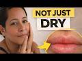 Why Are My Lips Always Dry? Lip Balm Isn’t Fixing This