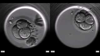 2embryos