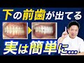 【受け口】顎は治らないが、歯だけなら2週間で治せる【矯正器具なし・手術なし】