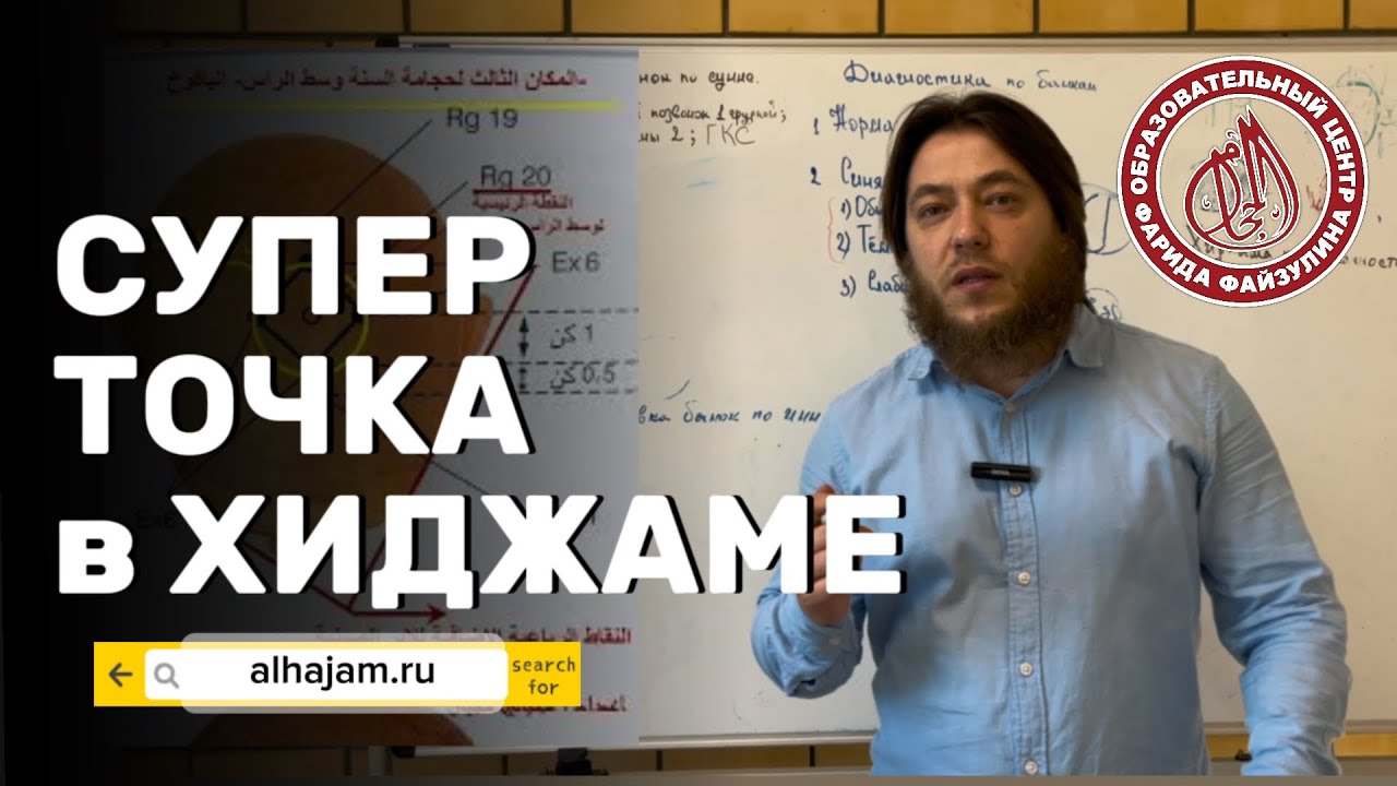 Точки хиджамы