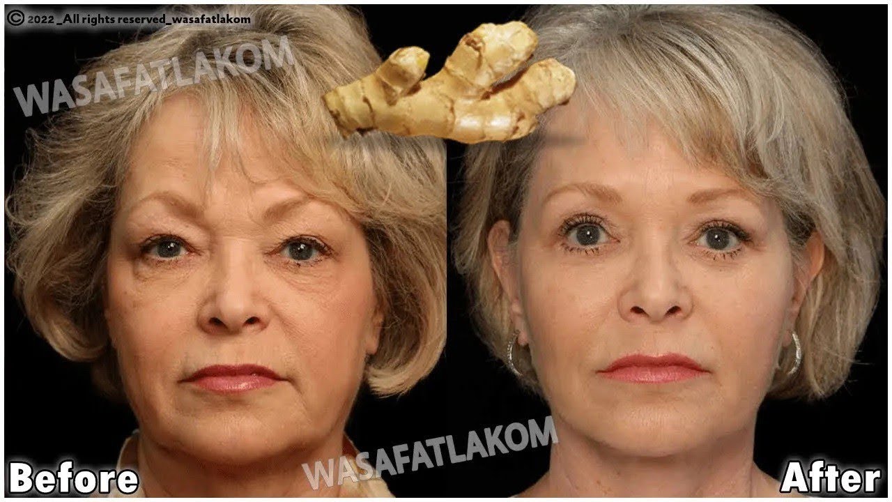 Collagen stimulation / Even if you are 70 years old, apply it to wrinkles, and they will disappear