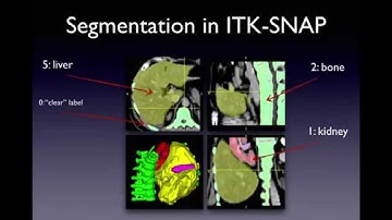 ITK-SNAP 3.2 User Training, Session 2: Theory: Working with 3D Medical Images