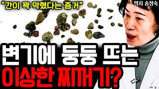 몸 속에 꽉 막힌 독소, '이 방법' 한 번이면 변기로 쏟아져 나옵니다 I 약사 송정숙 (통합본)