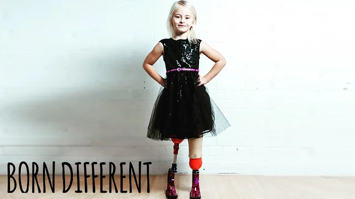 The Little Girl With No Legs And Big Dreams | BORN DIFFERENT - DayDayNews