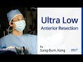 Ultra low anterior resection surgery