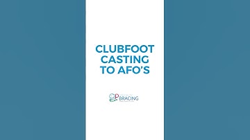 Clubfoot Casting to AFO