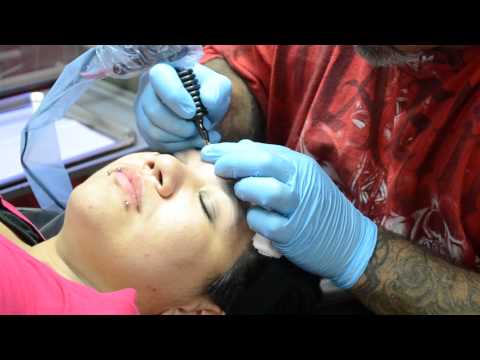 Unmarked: Christina Work gets face tattoo removed