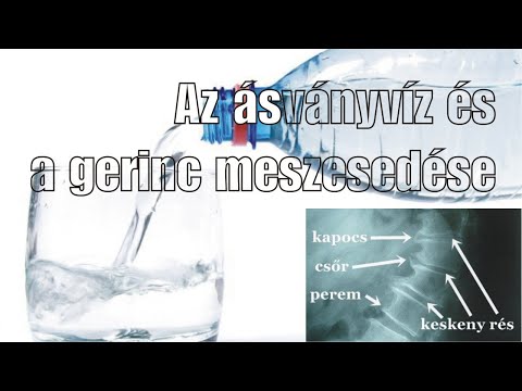 Videó: Diéta A Nyaki és ágyéki Gerinc Osteochondrosisához