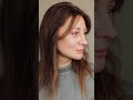 Результат работы Мною были выполнены: Подтяжка лба Средней зоны лица SMAS лифтинг 📲+79106208833