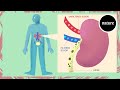 Acute kidney injury explained