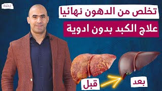 تنظيف سموم الكبد | شرح مختصر رائع لعلاج تشحم الكبد واعراضه بدون ادويه