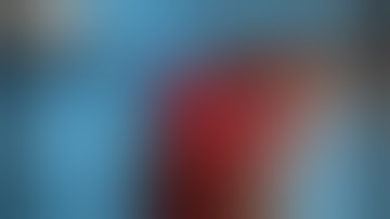 Frontal bone communited depressed fracture repair