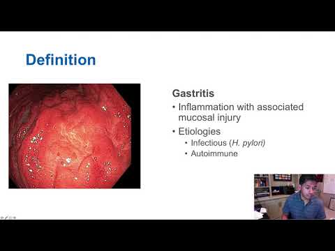 Videó: Akut Gastritis - Tünetek, Kezelés, étrend, Akut Gastritis Gyermekeknél