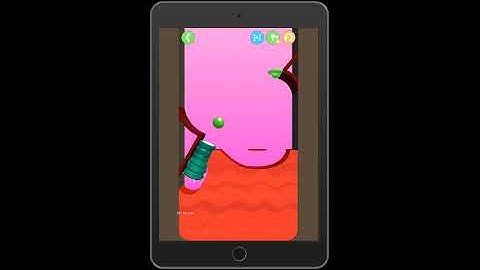 Dig this (Dig it) Level 207-14 | ZIGGY STARBALL| Chapter 207 level 14 Solution Walkthrough